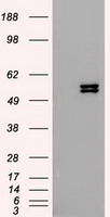 KRT8 / CK8 / Cytokeratin 8 Antibody - HEK293T cells were transfected with the pCMV6-ENTRY control (Left lane) or pCMV6-ENTRY KRT8 (Right lane) cDNA for 48 hrs and lysed. Equivalent amounts of cell lysates (5 ug per lane) were separated by SDS-PAGE and immunoblotted with anti-KRT8.