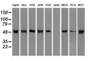 KRT8 / CK8 / Cytokeratin 8 Antibody - CK8 antibody (1B12) at 1:5000 dilution + Hela cell lysate.