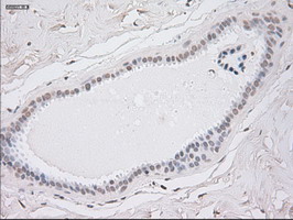 KRT8 / CK8 / Cytokeratin 8 Antibody - Anti-KRT8 mouse monoclonal antibody  immunofluorescent staining of COS7 cells transiently transfected by pCMV6-ENTRY KRT8.