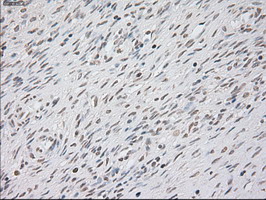 KRT8 / CK8 / Cytokeratin 8 Antibody - Immunofluorescent staining of A549 cells using anti-KRT8 mouse monoclonal antibody.