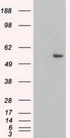 KRT8 / CK8 / Cytokeratin 8 Antibody - CK8 antibody (1B9) at 1:5000 dilution + Hela cell lysate.