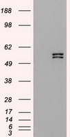 KRT8 / CK8 / Cytokeratin 8 Antibody - HEK293T cells were transfected with the pCMV6-ENTRY control (Left lane) or pCMV6-ENTRY KRT8 (Right lane) cDNA for 48 hrs and lysed. Equivalent amounts of cell lysates (5 ug per lane) were separated by SDS-PAGE and immunoblotted with anti-KRT8.