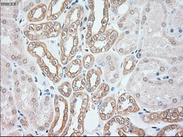 KRT8 / CK8 / Cytokeratin 8 Antibody - Anti-KRT8 mouse monoclonal antibody  immunofluorescent staining of COS7 cells transiently transfected by pCMV6-ENTRY KRT8.