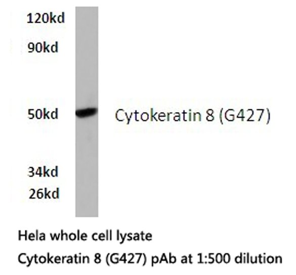 KRT8 / CK8 / Cytokeratin 8 Antibody - Western blot of K8 (G427) pAb in extracts from HeLa cells.