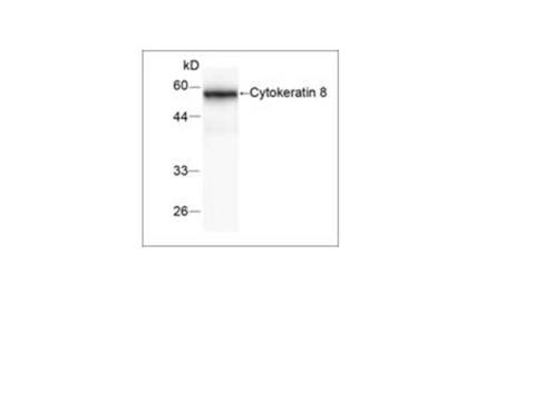 KRT8 / CK8 / Cytokeratin 8 Antibody