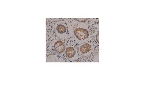 KRT8 / CK8 / Cytokeratin 8 Antibody