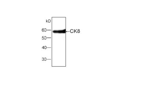 KRT8 / CK8 / Cytokeratin 8 Antibody