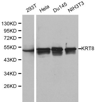 KRT8 / CK8 / Cytokeratin 8 Antibody - Western blot of Cytokeratin 8 pAb in extracts from 293T, Hela, Du145 and NIH3T3 cells.