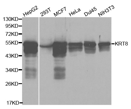 KRT8 / CK8 / Cytokeratin 8 Antibody - Western blot analysis of extracts of various cell lines, using KRT8 antibody at 1:1000 dilution. The secondary antibody used was an HRP Goat Anti-Rabbit IgG (H+L) at 1:10000 dilution. Lysates were loaded 25ug per lane and 3% nonfat dry milk in TBST was used for blocking.