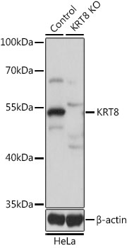 KRT8 / CK8 / Cytokeratin 8 Antibody - Western blot analysis of extracts from normal (control) and KRT8 knockout (KO) HeLa cells, using KRT8 antibodyat 1:1000 dilution. The secondary antibody used was an HRP Goat Anti-Rabbit IgG (H+L) at 1:10000 dilution. Lysates were loaded 25ug per lane and 3% nonfat dry milk in TBST was used for blocking. An ECL Kit was used for detection and the exposure time was 1s.
