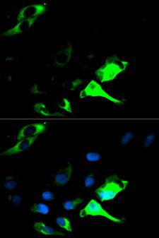 KRT8 / CK8 / Cytokeratin 8 Antibody - Immunofluorescence analysis of HeLa cells using KRT8 antibody. Blue: DAPI for nuclear staining.