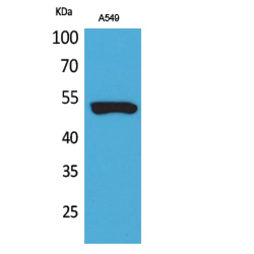 KRT8 / CK8 / Cytokeratin 8 Antibody - Western blot of Cytokeratin 8 antibody