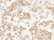 KRT8 / CK8 / Cytokeratin 8 Antibody -  This image was taken for the unconjugated form of this product. Other forms have not been tested.