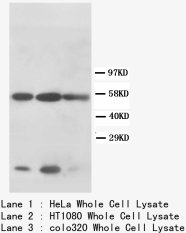 KRT8 / CK8 / Cytokeratin 8 Antibody -  This image was taken for the unconjugated form of this product. Other forms have not been tested.