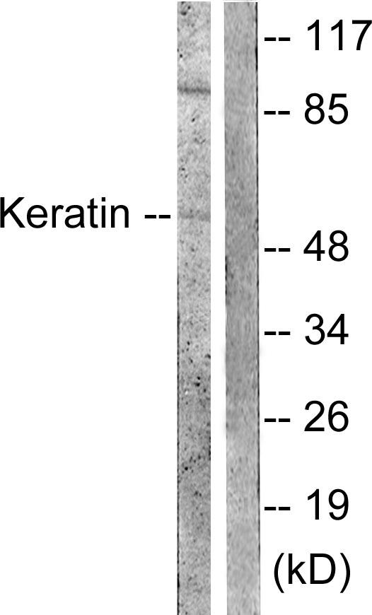 KRT8 / CK8 / Cytokeratin 8 Antibody - Western blot analysis of extracts from Hela cells treated with Anisomycin (25ug/ml, 30min), using Keratin 8 (Ab-73) antibody ( Line 1 and 2).
