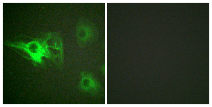 KRT8 / CK8 / Cytokeratin 8 Antibody - Immunofluorescence analysis of HeLa cells, using Keratin 8 (Phospho-Ser432) Antibody. The picture on the right is blocked with the phospho peptide.
