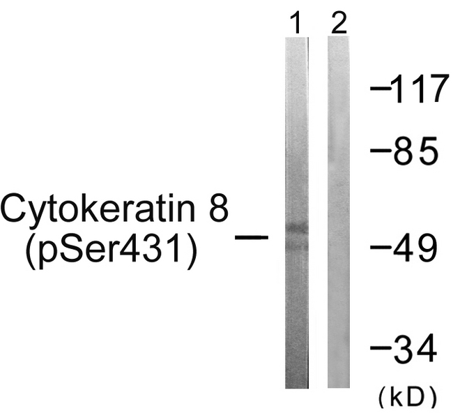 KRT8 / CK8 / Cytokeratin 8 Antibody - Western blot analysis of lysates from 293 cells treated with EGF 200ng/ml 30', using Keratin 8 (Phospho-Ser432) Antibody. The lane on the right is blocked with the phospho peptide.