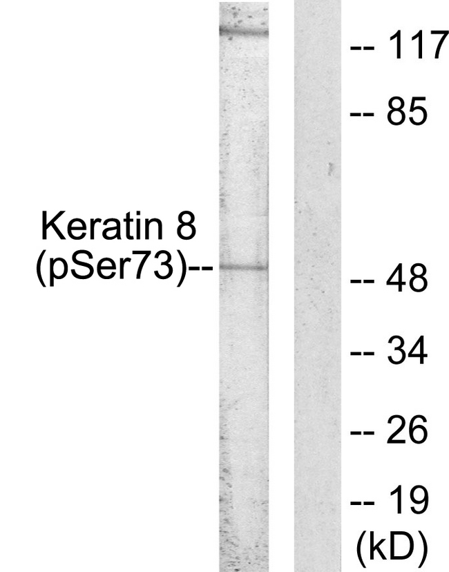 KRT8 / CK8 / Cytokeratin 8 Antibody - Western blot analysis of lysates from 293 cells treated with Etoposide 25uM 60', using Keratin 8 (Phospho-Ser73) Antibody. The lane on the right is blocked with the phospho peptide.