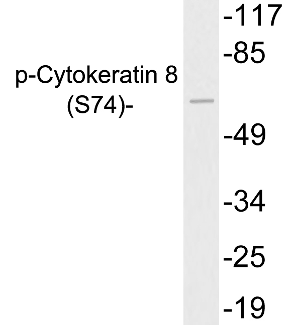 KRT8 / CK8 / Cytokeratin 8 Antibody - Western blot analysis of lysates from 293 cells treated with UV, using p-Cytokeratin 8 (Phospho-Ser74) antibody.