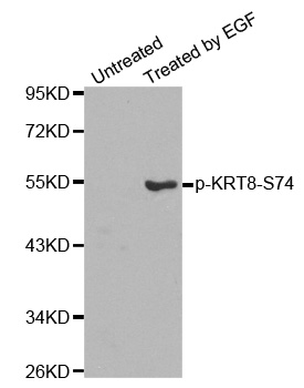 KRT8 / CK8 / Cytokeratin 8 Antibody - Western blot analysis of extracts from HepG2 cells.