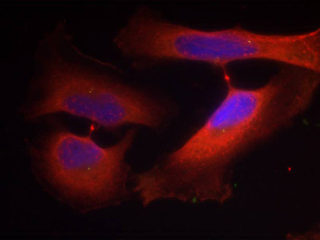 KRT8 / CK8 / Cytokeratin 8 Antibody - Immunofluorescence staining of methanol-fixed Hela cells.