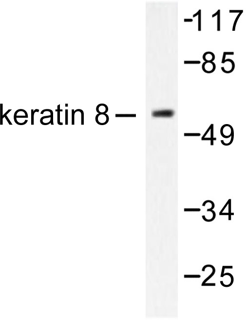 KRT8 / CK8 / Cytokeratin 8 Antibody - Western blot of Cytokeratin 8 (V463) pAb in extracts from SKOV3 cells.