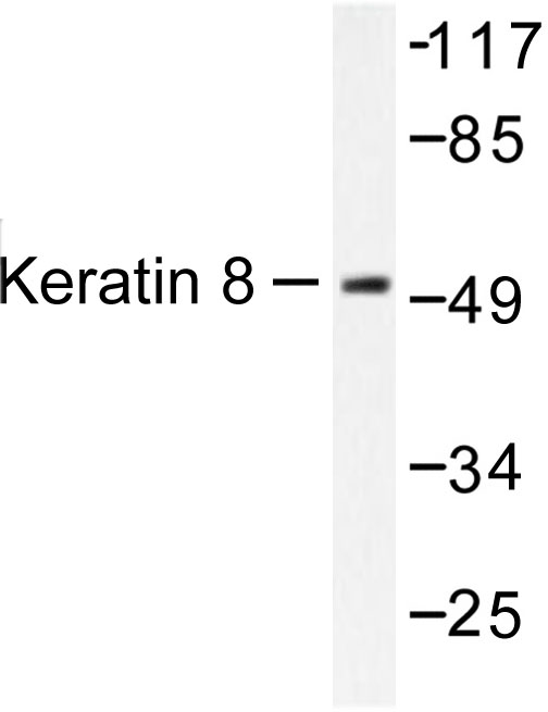KRT8 / CK8 / Cytokeratin 8 Antibody - Western blot of Cytokeratin 8 (V67) pAb in extracts from HeLa treated with Anisomycin 25 ug/ml 30'.
