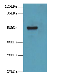 KRT80 / Keratin 80 Antibody - Western blot. All lanes: KRT80 antibody at 2 ug/ml+Mos- brain tissue Goat polyclonal to rabbit at 1:10000 dilution. Predicted band size: 51 kDa. Observed band size: 51 kDa.