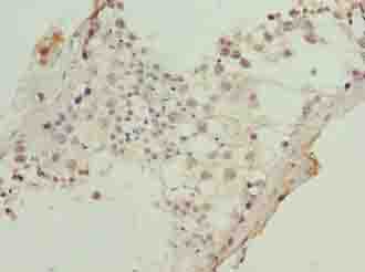KRT80 / Keratin 80 Antibody - Immunohistochemistry of paraffin-embedded human testis tissue using antibody at dilution of 1:100.