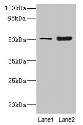 KRT80 / Keratin 80 Antibody - Western blot All lanes: KRT80 antibody at 2µg/ml + Mouse brain tissue Secondary Goat polyclonal to rabbit IgG at 1/10000 dilution Predicted band size: 51, 48, 55 kDa Observed band size: 51 kDa
