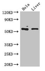 KRT81 / Keratin 81 / KRTHB1 Antibody - Western Blot Positive WB detected in: Hela whole cell lysate, HepG2 whole cell lysate, HEK293 whole cell lysate, Mouse liver tissue All lanes: KRT81 antibody at 5µg/ml Secondary Goat polyclonal to rabbit IgG at 1/50000 dilution Predicted band size: 55 kDa Observed band size: 55, 60 kDa