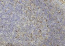KRT81 / Keratin 81 / KRTHB1 Antibody - 1:100 staining human lymph node tissue by IHC-P. The sample was formaldehyde fixed and a heat mediated antigen retrieval step in citrate buffer was performed. The sample was then blocked and incubated with the antibody for 1.5 hours at 22°C. An HRP conjugated goat anti-rabbit antibody was used as the secondary.