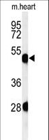 KRT82 / Keratin 82 / KRTHB2 Antibody - Western blot of KRT82 Antibody in mouse heart tissue lysates (35 ug/lane). KRT82 (arrow) was detected using the purified antibody.