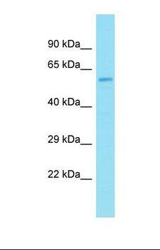 KRT82 / Keratin 82 / KRTHB2 Antibody - Western blot of Human 721_B. KRTHB2 antibody dilution 1.0 ug/ml.  This image was taken for the unconjugated form of this product. Other forms have not been tested.