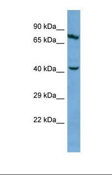 KRT83 / Keratin 83 / KRTHB3 Antibody - Western blot of Human COLO205. KRT83 antibody dilution 1.0 ug/ml.  This image was taken for the unconjugated form of this product. Other forms have not been tested.