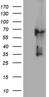 KRT84 / Keratin 84 / KRTHB4 Antibody - HEK293T cells were transfected with the pCMV6-ENTRY control. (Left lane) or pCMV6-ENTRY KRT84. (Right lane) cDNA for 48 hrs and lysed. Equivalent amounts of cell lysates. (5 ug per lane) were separated by SDS-PAGE and immunoblotted with anti-KRT84. (1:500)