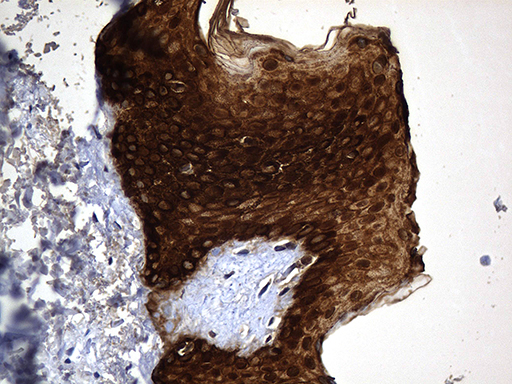 KRT84 / Keratin 84 / KRTHB4 Antibody - Immunohistochemical staining of paraffin-embedded Human skin tissue within the normal limits using anti-KRT84 mouse monoclonal antibody. (Heat-induced epitope retrieval by 1mM EDTA in 10mM Tris buffer. (pH8.5) at 120 oC for 3 min. (1:500)