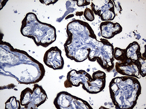 KRT84 / Keratin 84 / KRTHB4 Antibody - Immunohistochemical staining of paraffin-embedded Human placenta tissue within the normal limits using anti-KRT84 mouse monoclonal antibody. (Heat-induced epitope retrieval by 1mM EDTA in 10mM Tris buffer. (pH8.5) at 120 oC for 3 min. (1:500)