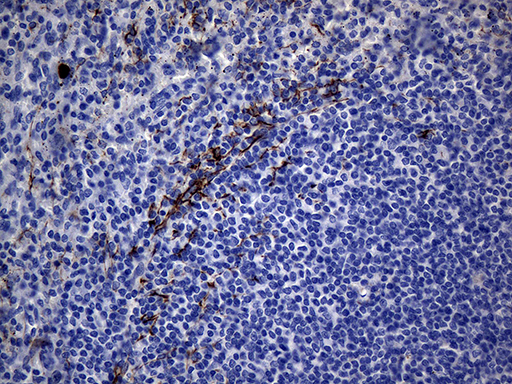 KRT84 / Keratin 84 / KRTHB4 Antibody - Immunohistochemical staining of paraffin-embedded Human spleen tissue within the normal limits using anti-KRT84 mouse monoclonal antibody. (Heat-induced epitope retrieval by Tris-EDTA(1:500)
