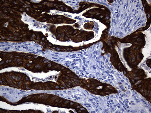 KRT84 / Keratin 84 / KRTHB4 Antibody - Immunohistochemical staining of paraffin-embedded Carcinoma of Human spleen tissue within the normal limits using anti-KRT84 mouse monoclonal antibody. (Heat-induced epitope retrieval by 1mM EDTA in 10mM Tris buffer. (pH8.5) at 120°C for 3 min. (1:500)