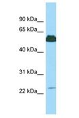KRT85 / Keratin 85 / KRTHB5 Antibody - KRT85 antibody Western Blot of 721_B. Antibody dilution: 1 ug/ml.  This image was taken for the unconjugated form of this product. Other forms have not been tested.