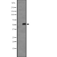 KRT85 / Keratin 85 / KRTHB5 Antibody - Western blot analysis of KRT85/86 expression in OVCAR 3 cells lysate. The lane on the left is treated with the antigen-specific peptide.
