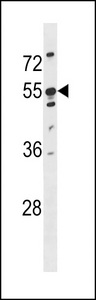 KRT86 / Keratin 86 / KRTHB6 Antibody - KRT86 Antibody western blot of U251 cell line lysates (35 ug/lane). The KRT86 antibody detected the KRT86 protein (arrow).