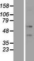 KRT86 / Keratin 86 / KRTHB6 Protein - Western validation with an anti-DDK antibody * L: Control HEK293 lysate R: Over-expression lysate