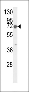 KRT9 / CK9 / Cytokeratin 9 Antibody - Western blot of KRT9 Antibody (Center K317) in HL-60 cell line lysates (35 ug/lane). KRT9 (arrow) was detected using the purified antibody.