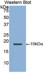 KRT9 / CK9 / Cytokeratin 9 Antibody - Western blot of recombinant KRT9 / K9.  This image was taken for the unconjugated form of this product. Other forms have not been tested.