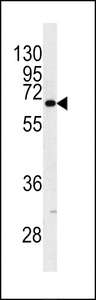 KRT9 / CK9 / Cytokeratin 9 Antibody - Western blot of KRT9 antibody (Center K444) in NCI-H460 cell line lysates (35 ug/lane). KRT9 (arrow) was detected using the purified antibody.