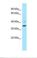 KRT9 / CK9 / Cytokeratin 9 Antibody - Western blot of Human COLO205. KRT9 antibody dilution 1.0 ug/ml.  This image was taken for the unconjugated form of this product. Other forms have not been tested.