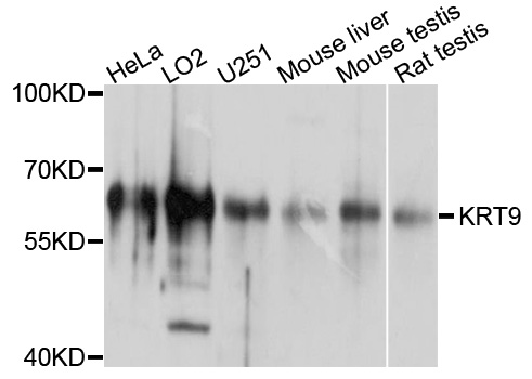 KRT9 / CK9 / Cytokeratin 9 Antibody - Western blot analysis of extracts of various cell lines, using KRT9 antibody at 1:1000 dilution. The secondary antibody used was an HRP Goat Anti-Rabbit IgG (H+L) at 1:10000 dilution. Lysates were loaded 25ug per lane and 3% nonfat dry milk in TBST was used for blocking. An ECL Kit was used for detection and the exposure time was 5s.