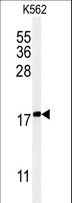 KRTAP1-1 Antibody - Western blot of KRTAP1-1 Antibody in K562 cell line lysates (35 ug/lane). KRTAP1-1 (arrow) was detected using the purified antibody.